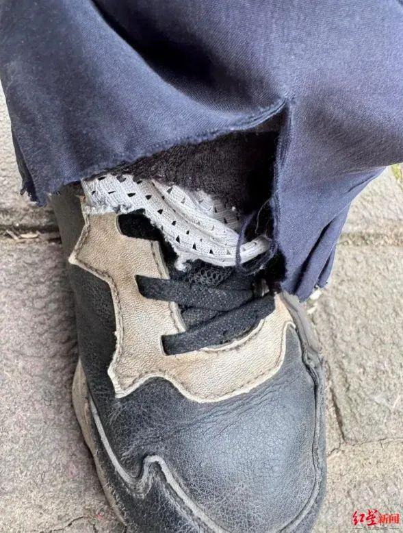 九游app：厦门夫妻车祸去世腹中胎儿被挤压降生！11年后孩子却成了这样…(图9)